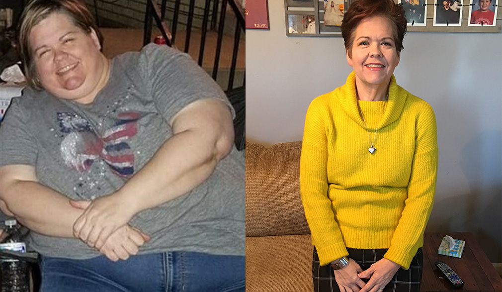 Shannon's weight loss transformation