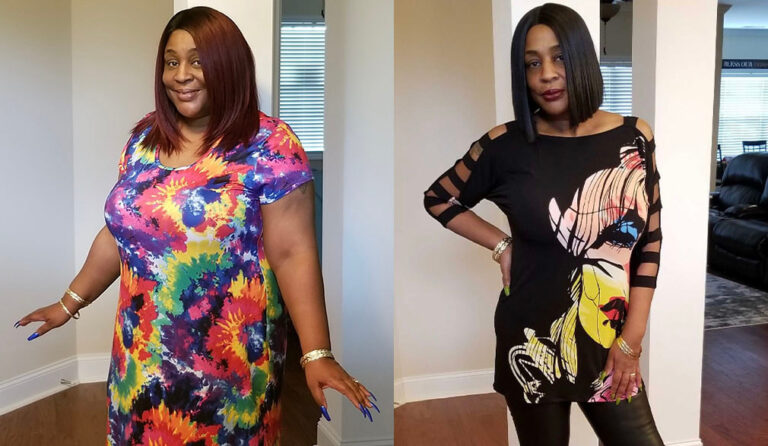 Dawn's weight loss transformation