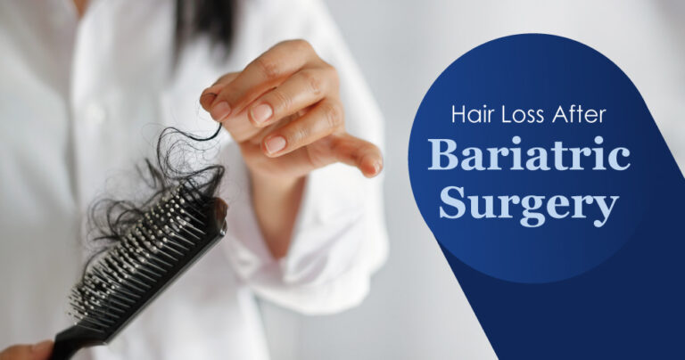 Understanding Hair Loss After Weight Loss Surgery