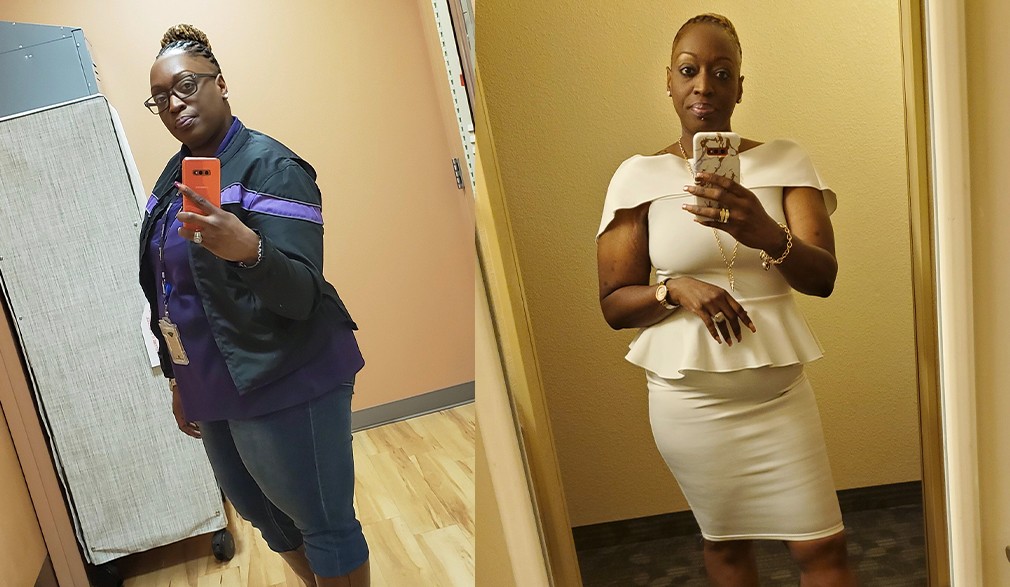 Mildred weight loss transformation