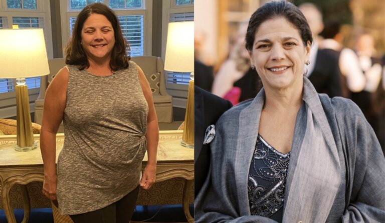 Debra's weight loss transformation