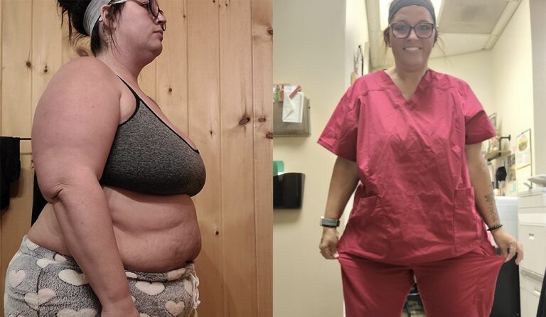Elizabeth's weight loss transformation