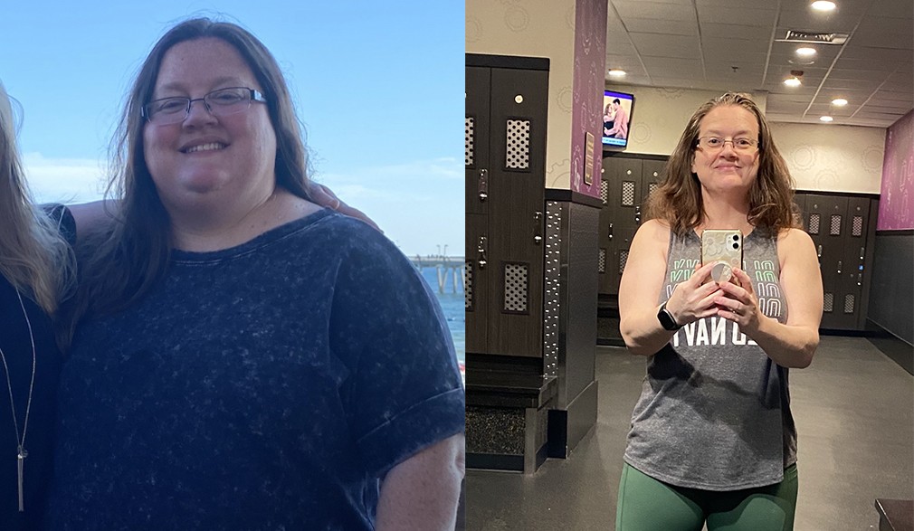 Mandy's weight loss transformation