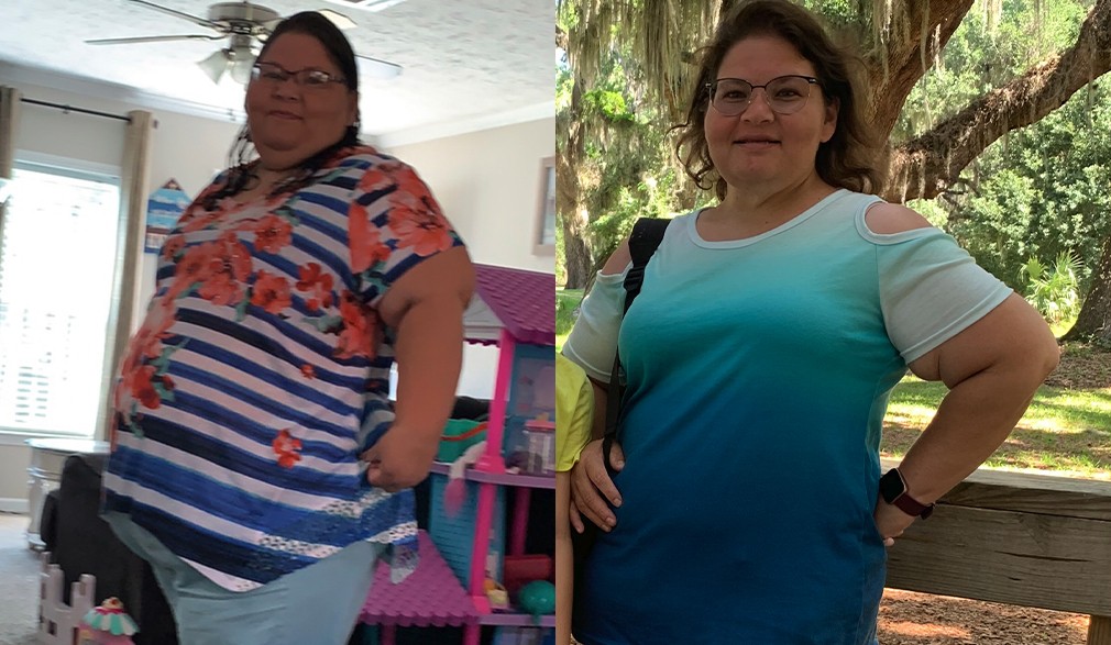Lucia's weight loss transformation