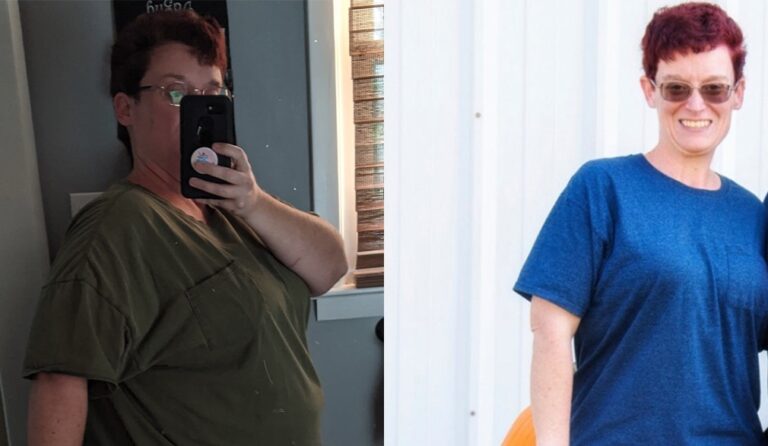 Dagny's Weight Loss Transformation