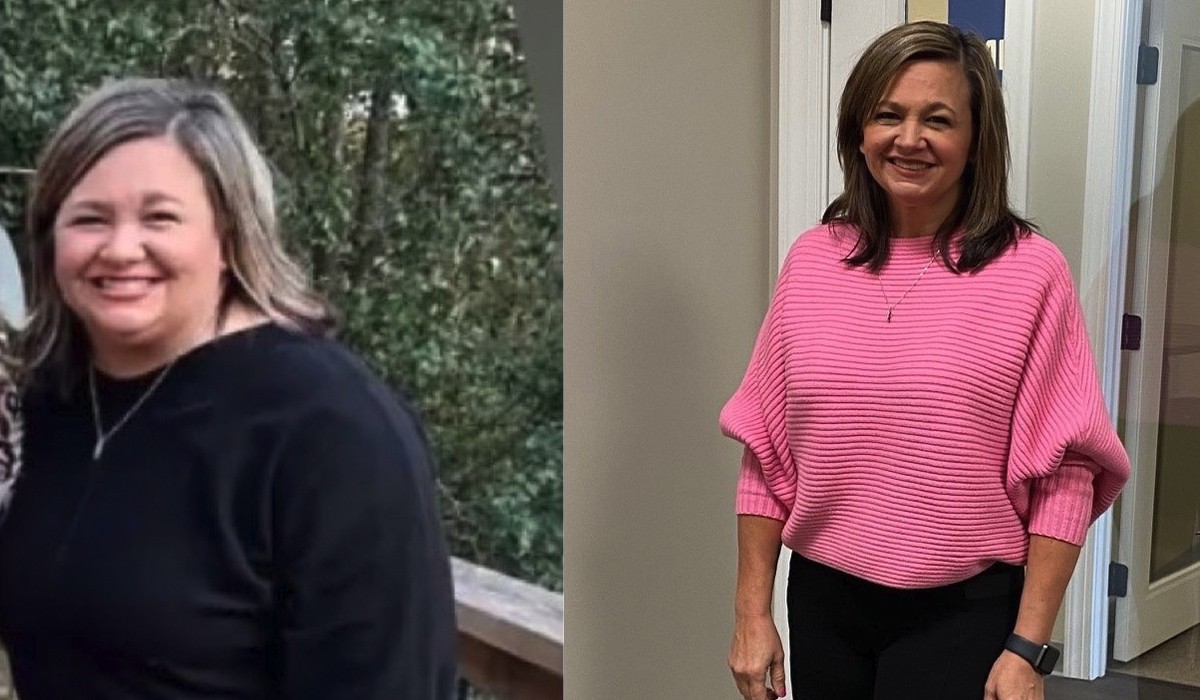 Tonya's weight loss transformation