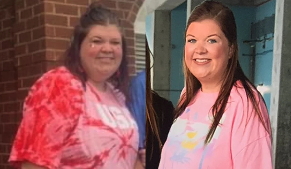 Jessica's weight loss transformation