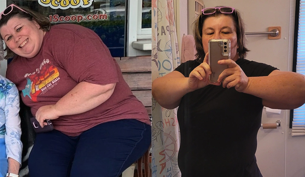 Lynnette's weight loss transformation