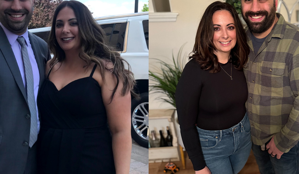 Alyssa Before & After