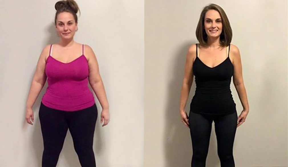 Jennie before and after bariatric surgery